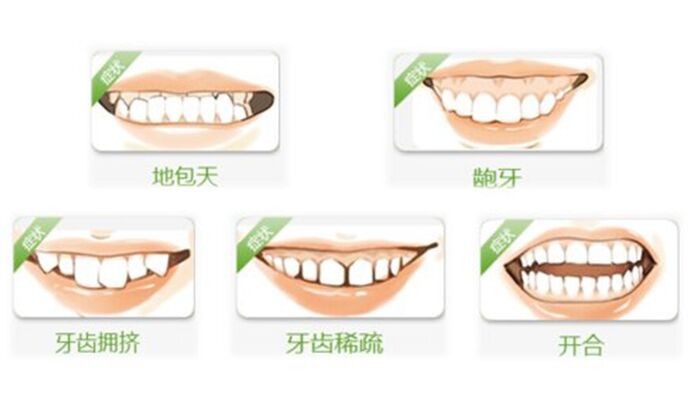 牙齿不矫正有哪些危害？