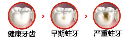 牙疼拔牙有什么后果呢