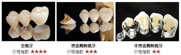 南京烤瓷牙可以用多少年